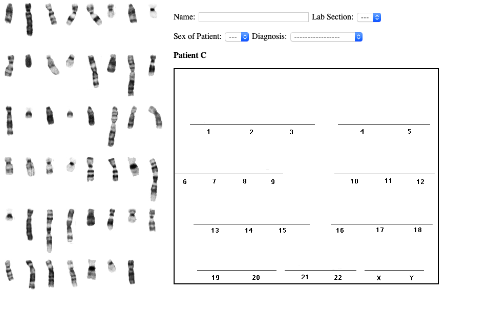 Solved Human Karyotype Lab Exercise WARNING: Read all of the | Chegg.com