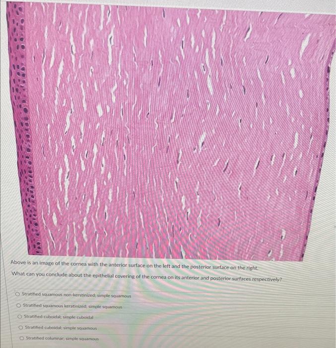 Solved Mucus secretion is most associated with the structure | Chegg.com