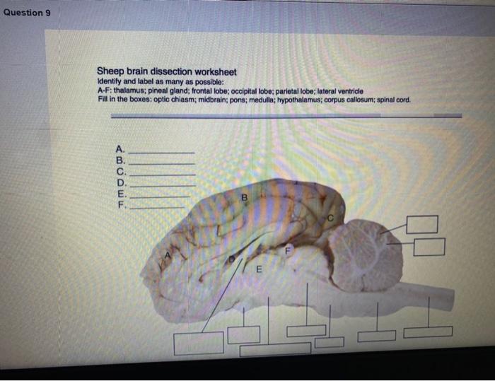 Solved Question 7 Needs Grading Identify The Tissue Ident...