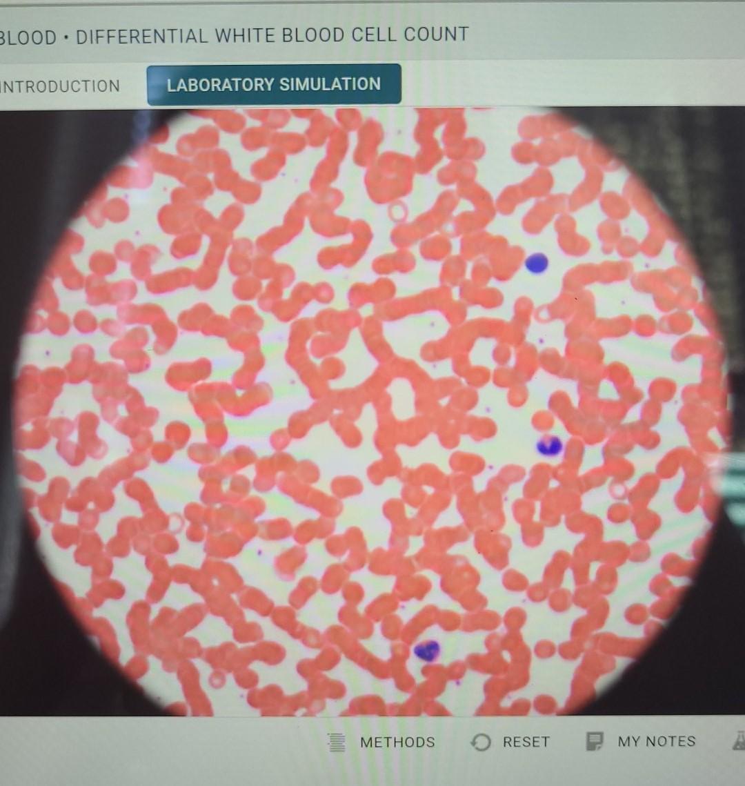 BLOOD DIFFERENTIAL WHITE BLOOD CELL COUNT | Chegg.com