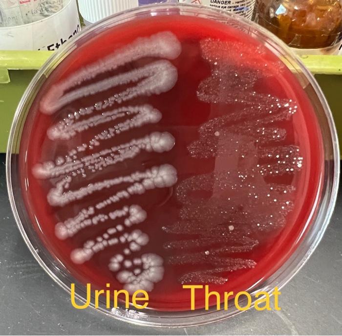Solved A. Throat cultures 1) Examine your blood agar plates