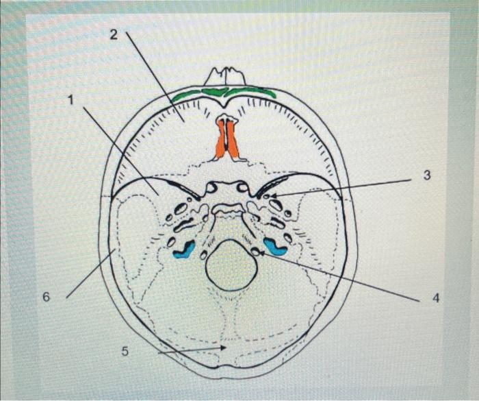 Solved On the diagram above, select the most appropriate | Chegg.com