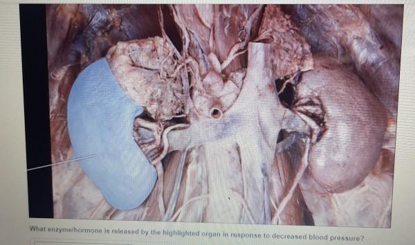 Identify the highlighted region of the thyroid gland.