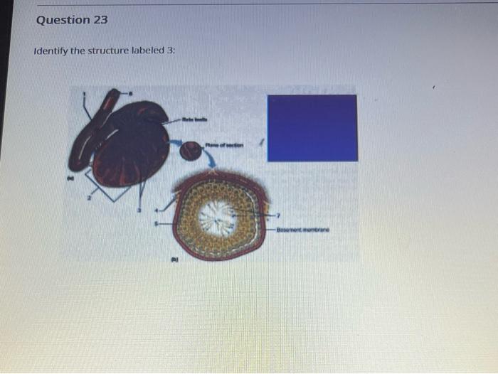 Solved Identify the structure labeled 2:Identify the | Chegg.com