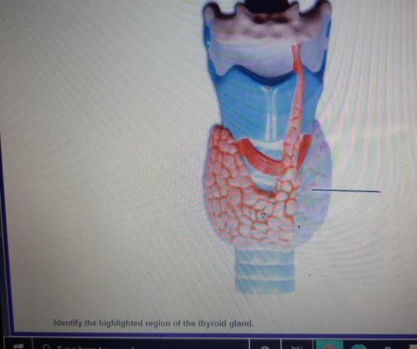 Identify the highlighted region of the thyroid gland.