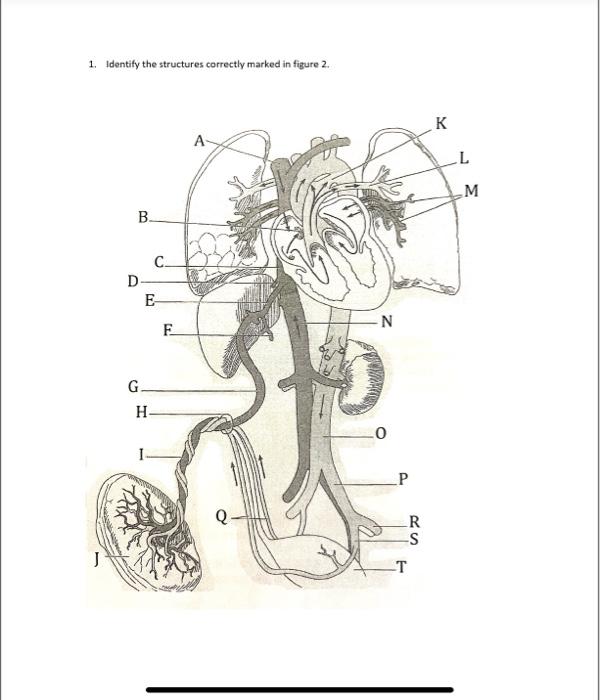 Solved 1. Identify the structures correctly marked in figure | Chegg.com