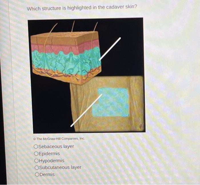 Solved Which structure is highlighted in the cadaver skin?