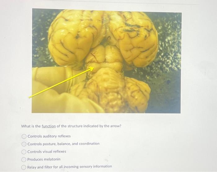 Solved Identify the structure labeled A. Identify the | Chegg.com