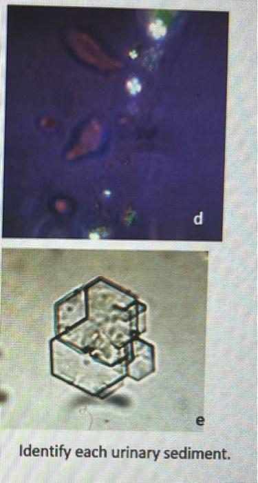 Solved e Identify each urinary sediment. | Chegg.com