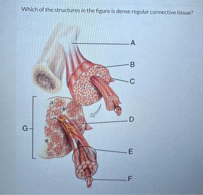 Solved Which of the structures in the figure is dense | Chegg.com