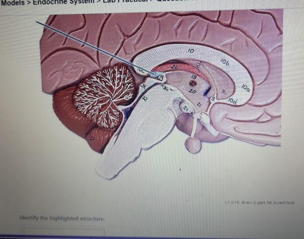 Solved Identify the highlighted region of the thyroid gland.