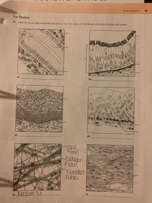 31 Label The Tissue Types Illustrated Here And On The Next Page Label