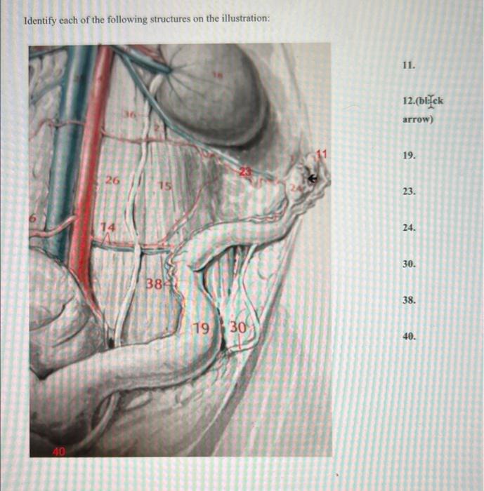 Solved Identify each of the following structures on the | Chegg.com