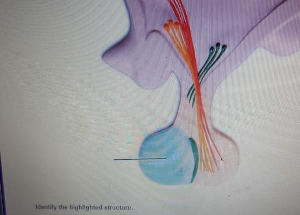 Identify the highlighted region of the thyroid gland.