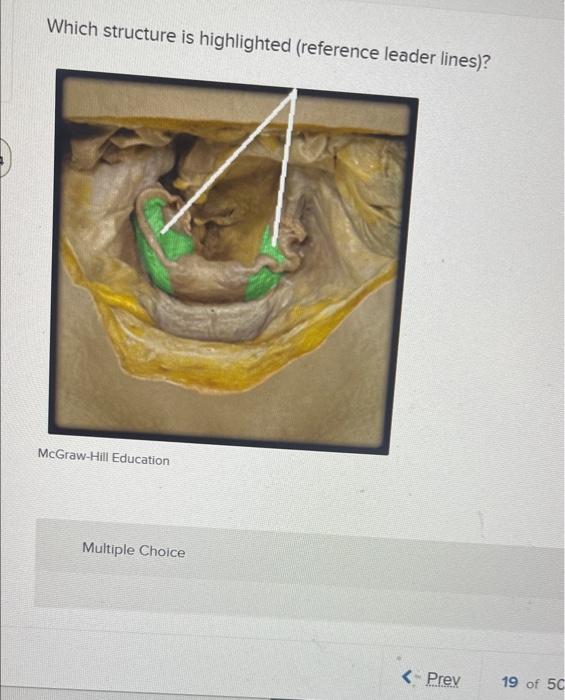 Solved Which structure is highlighted (reference leader