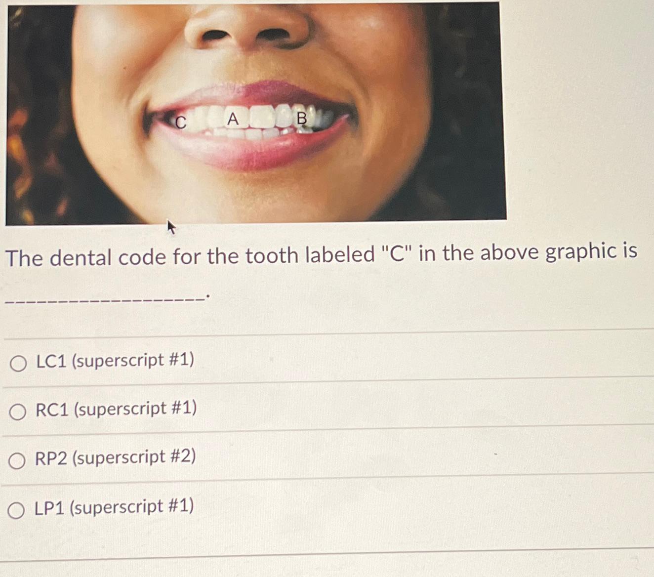 The dental code for the tooth labeled " C " ﻿in the