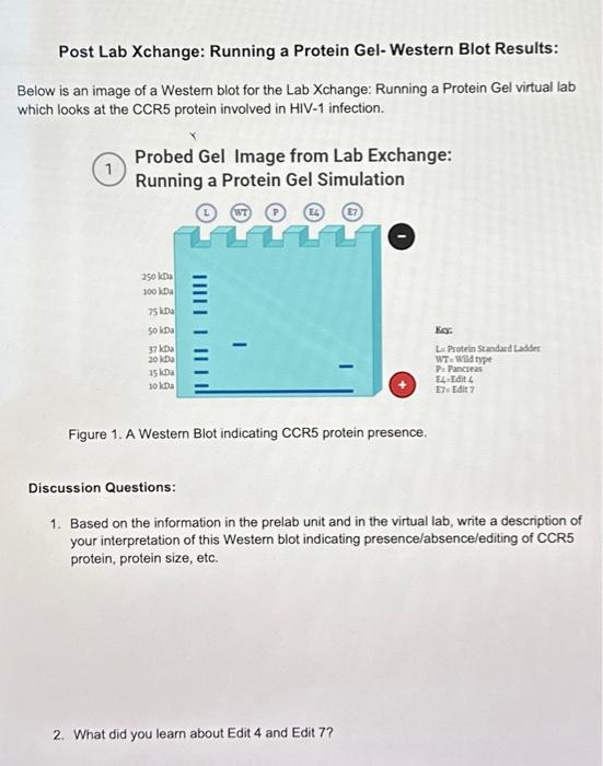 Solved Post Lab Xchange Running a Protein Gel Western Blot