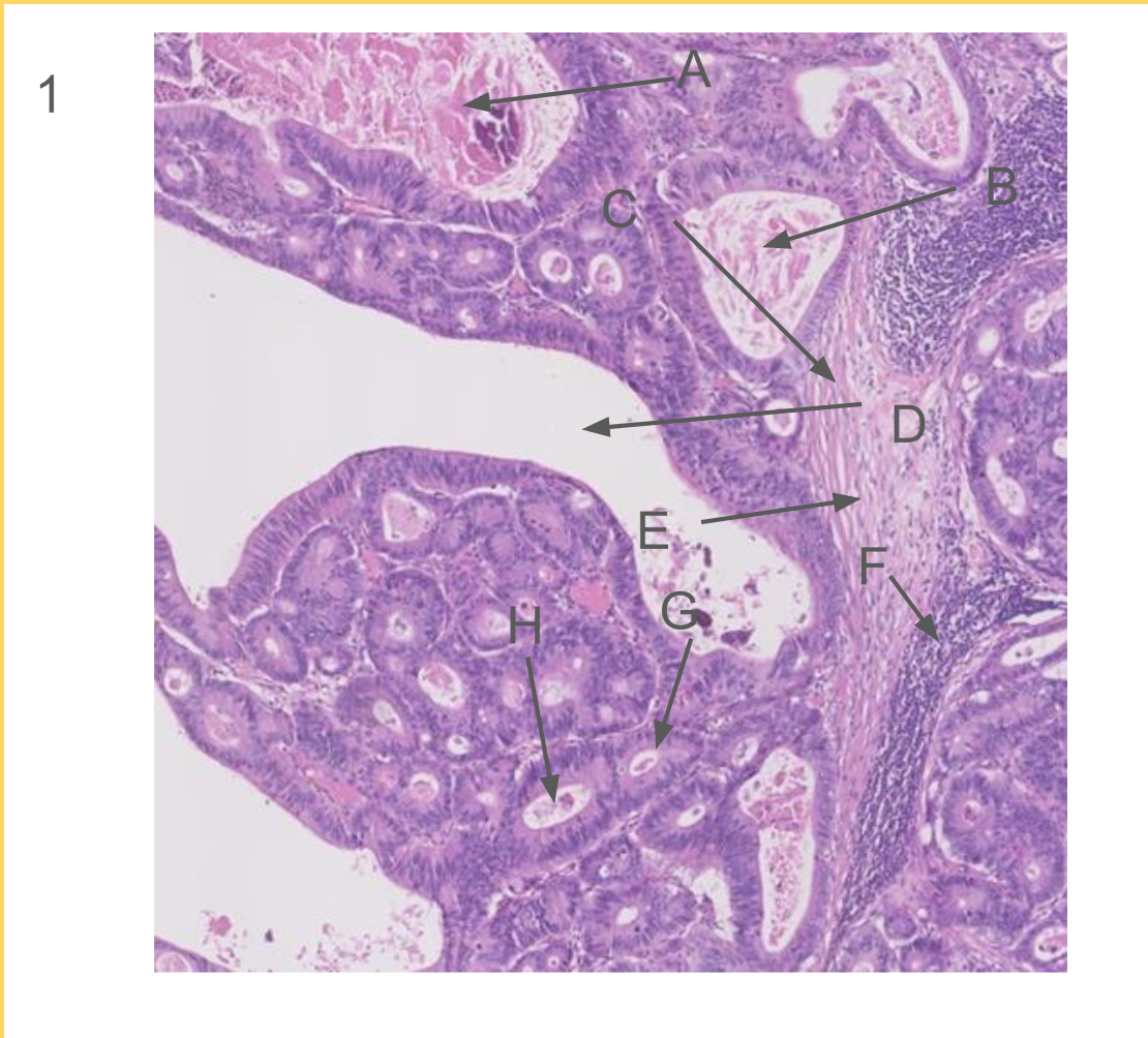 Solved Can you please label this and describe the histology- | Chegg.com