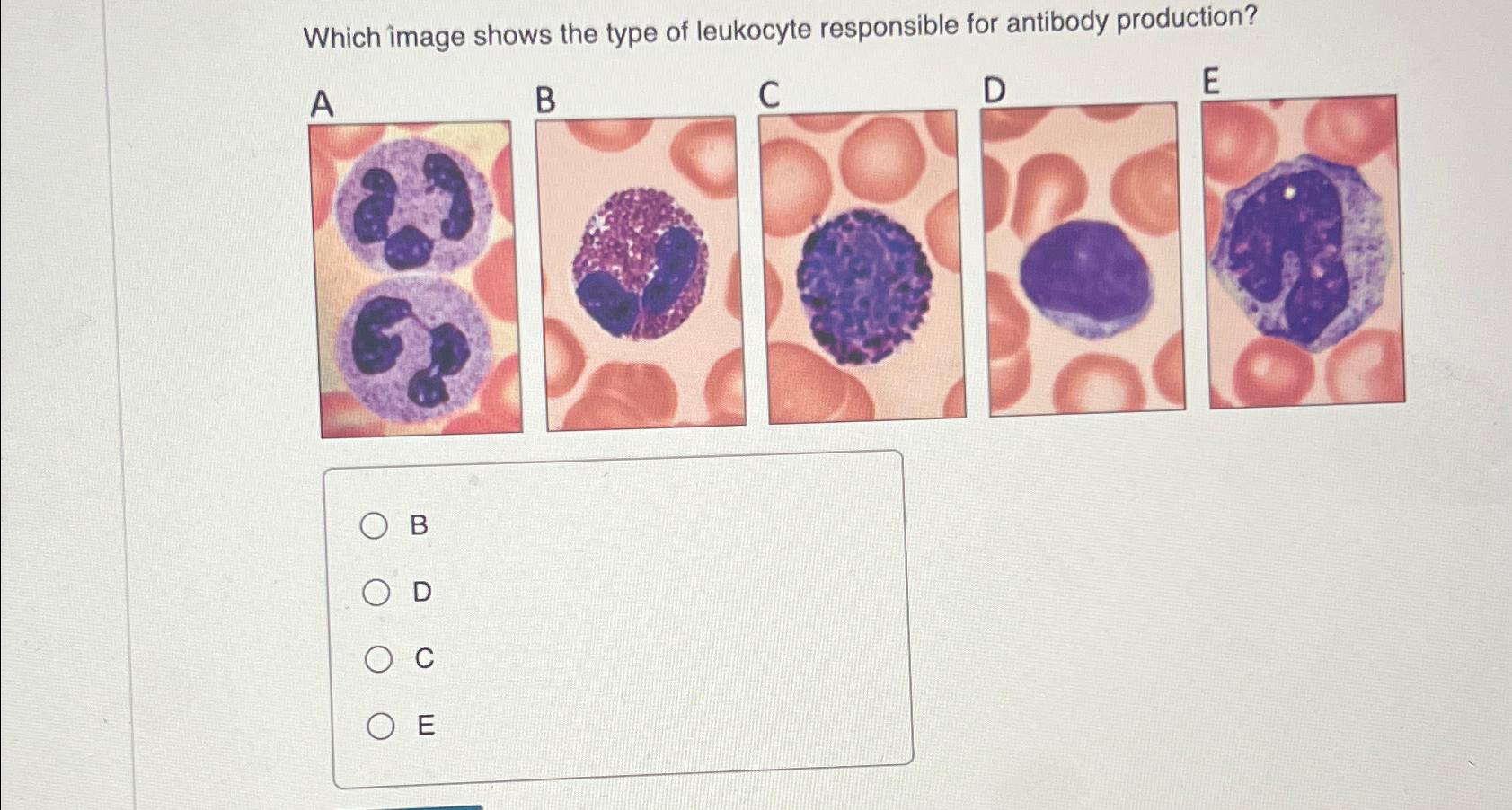 Solved Which image shows the type of leukocyte responsible