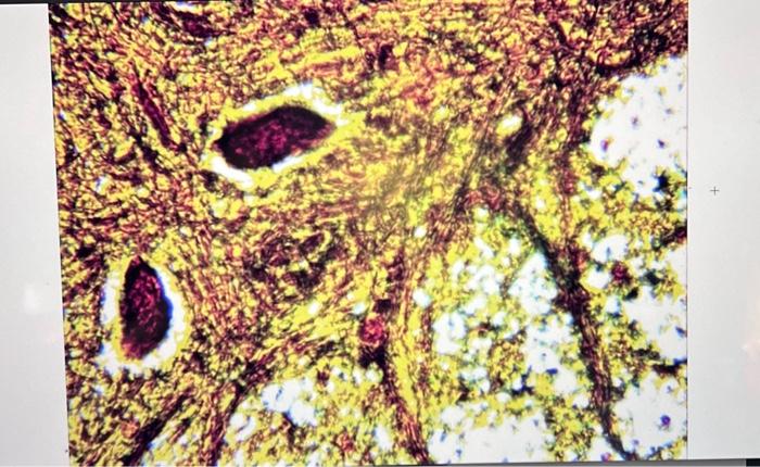 Solved Describe the structure and function of dendrites. | Chegg.com