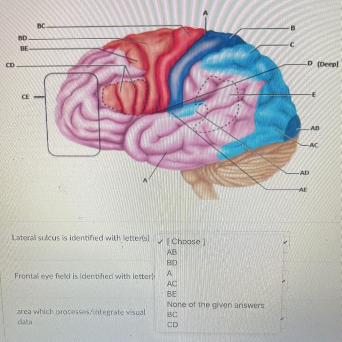 Solved Lateral sulcus is identified with letter(s) Frontal