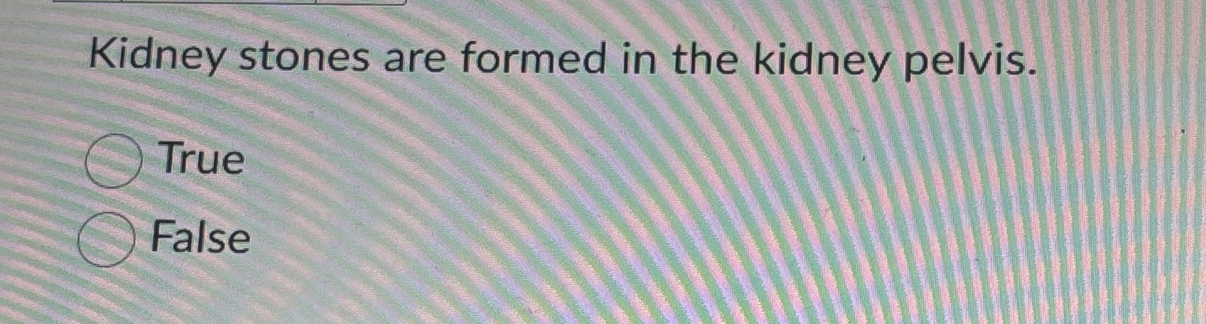Solved Kidney stones are formed in the kidney pelvis.