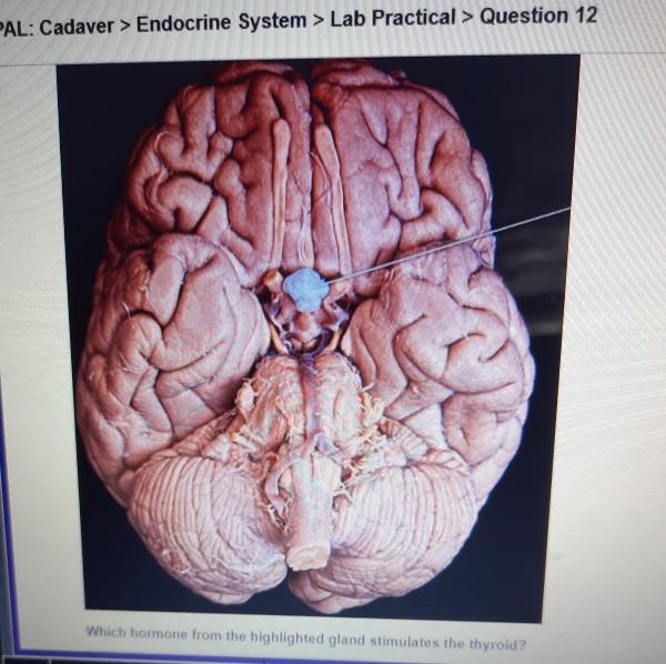 Identify the highlighted region of the thyroid gland.