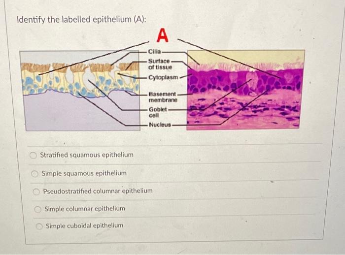 Solved Identify the labelled epithelium (A) Simple cuboidal