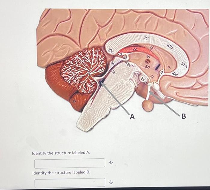 Solved Identify the structure labeled A. Identify the | Chegg.com