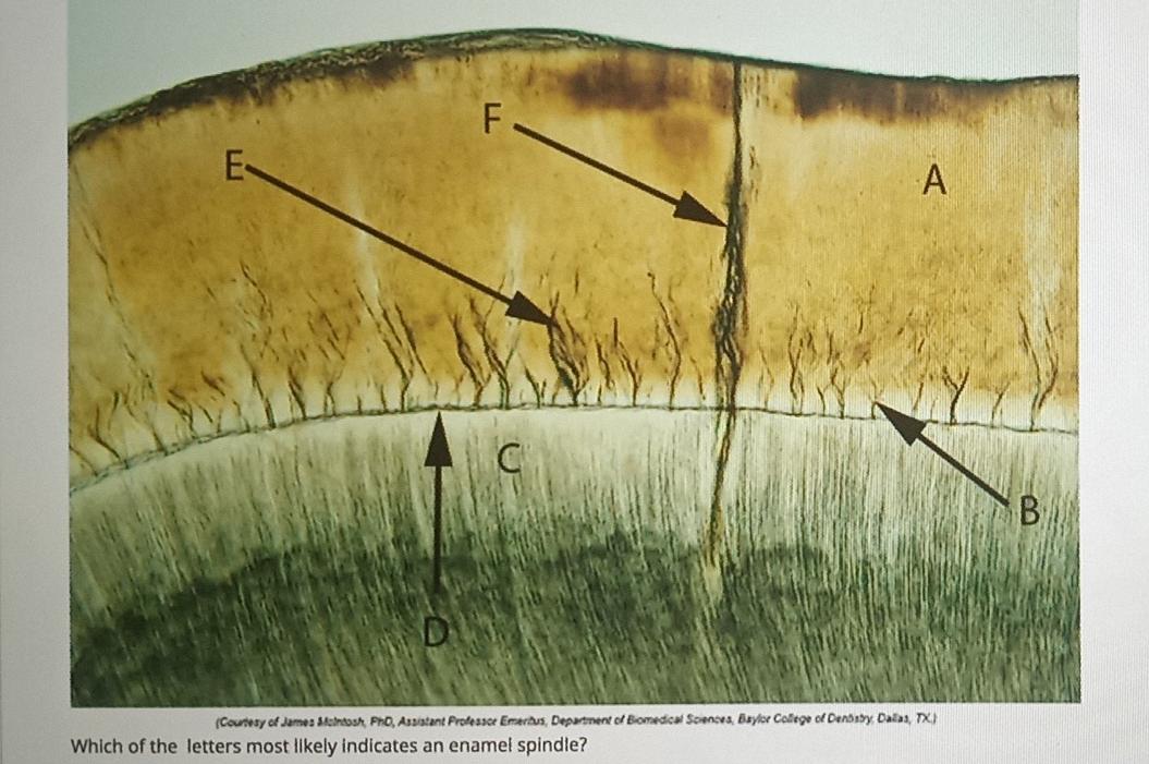Solved Which of the letters most likely indicates an enamel