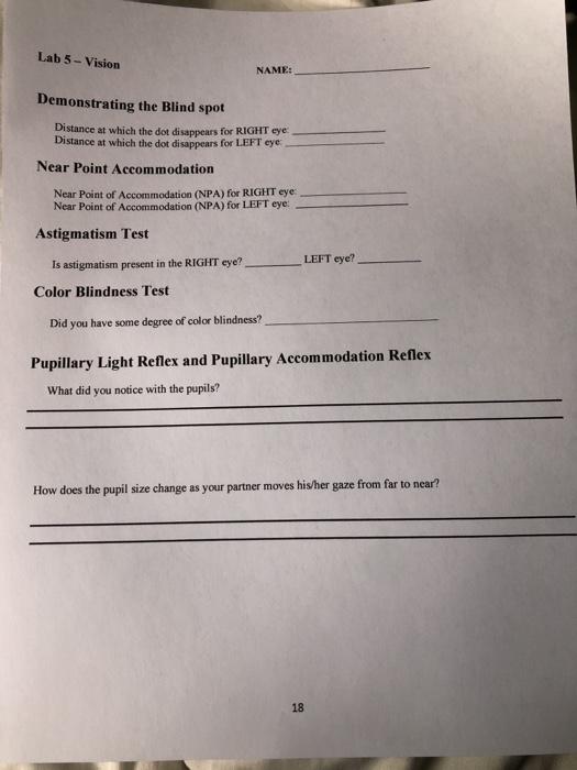 Lab 5 - Vision NAME: Demonstrating the Blind spot | Chegg.com