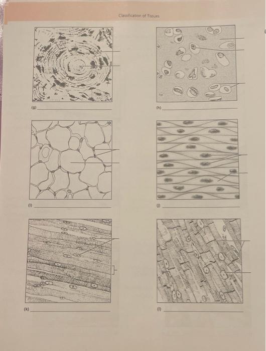 Solved label the tissue types illustrated here and identify
