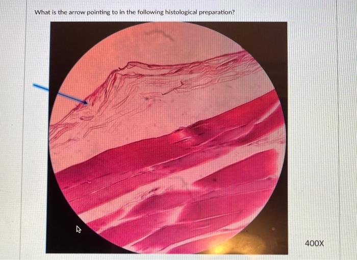 Solved What is the arrow pointing to in the following