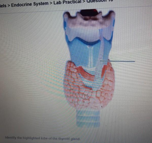 Identify the highlighted region of the thyroid gland.