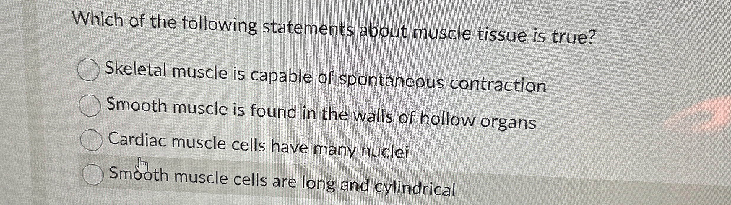 Solved Which of the following statements about muscle tissue