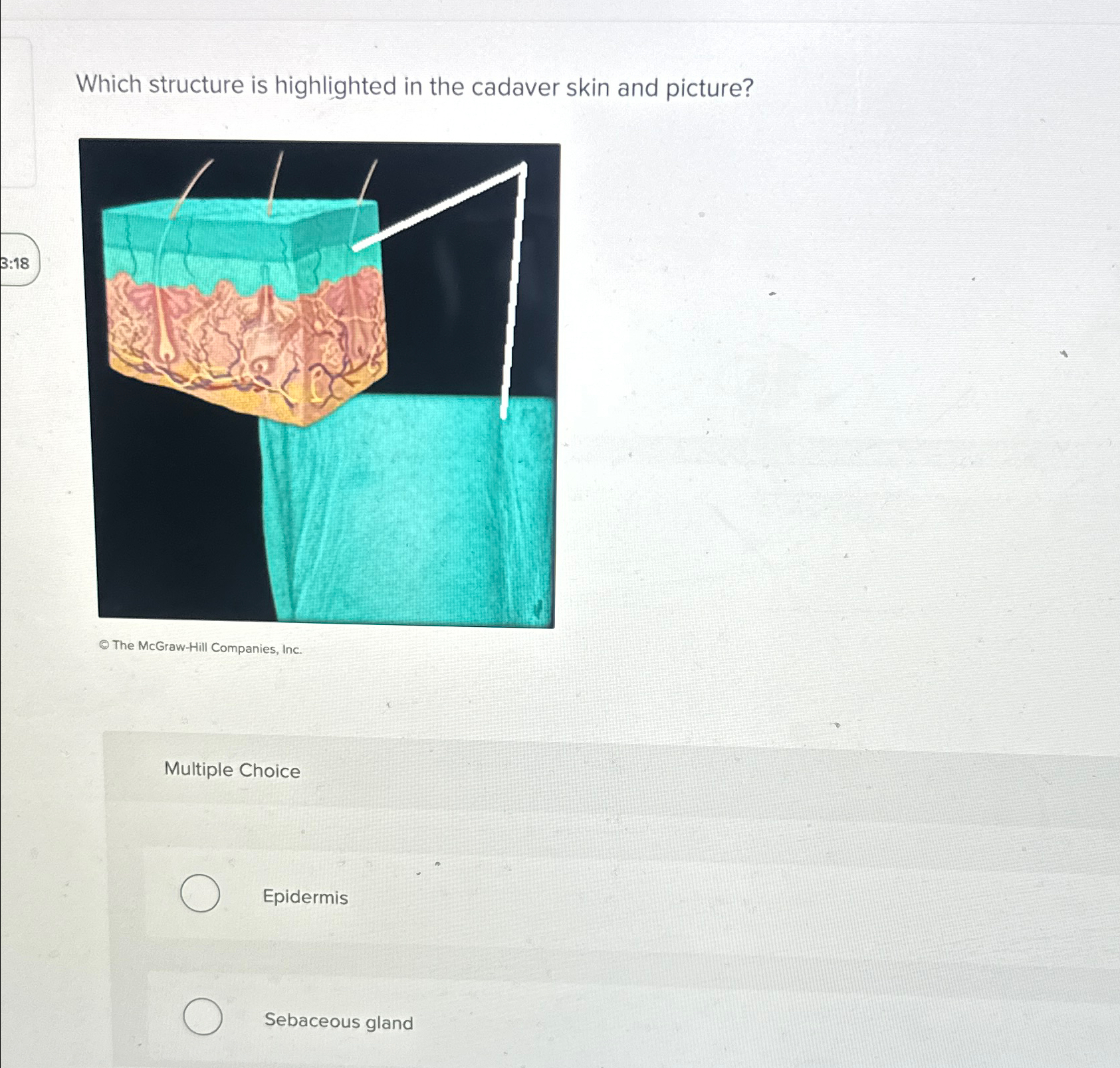 Solved Which structure is highlighted in the cadaver skin