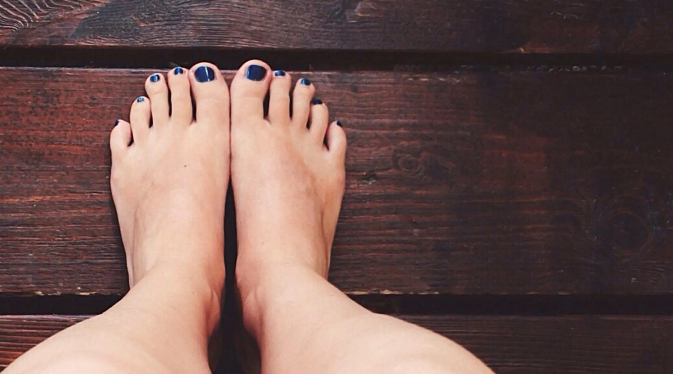 Combatting Swollen Feet During Pregnancy
