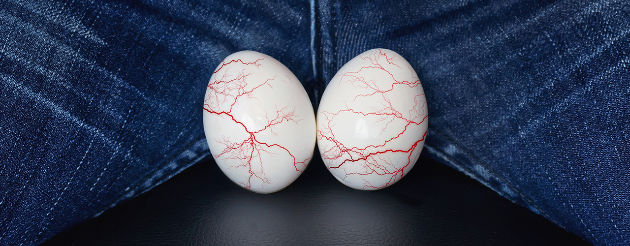 Effective Varicocele Treatment in Bangalore Top Specialists