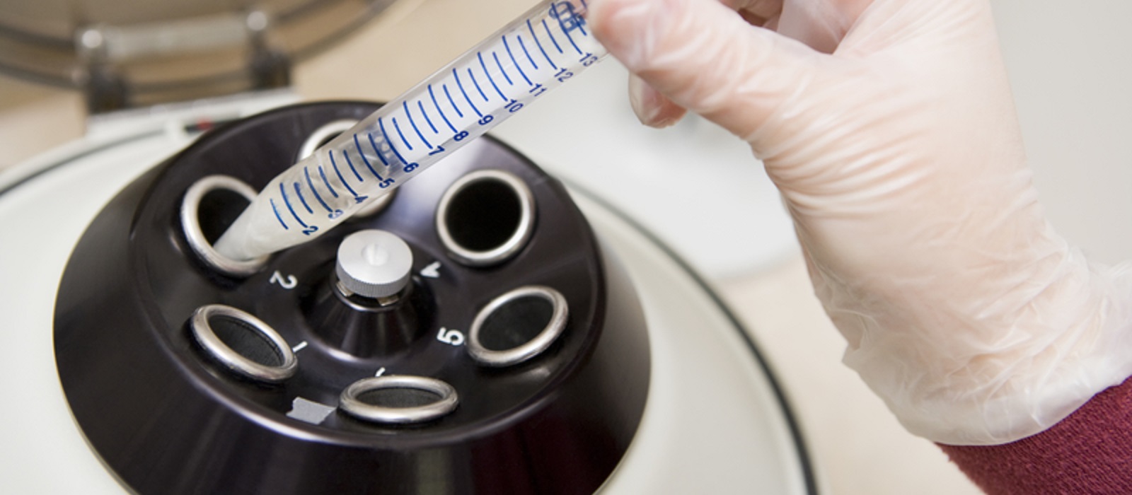 Improving Centrifuge Operation in 7 Steps