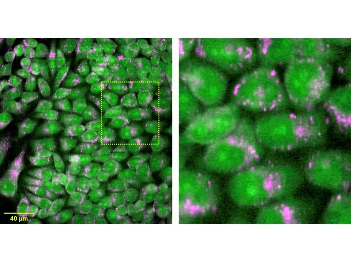 New Raman Microscopy Approach Is 100s of Times Faster Than Conventional