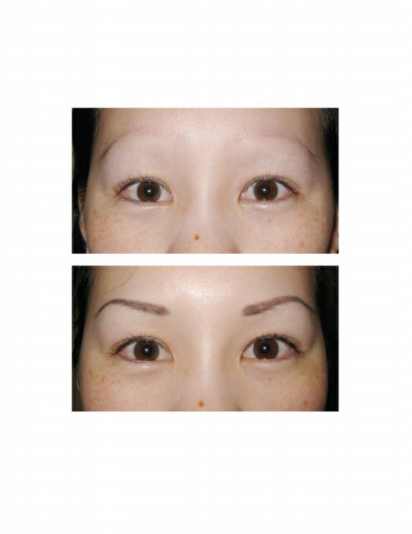 Pictures for JuvEssentials San Francisco's Premier SofTap Permanent