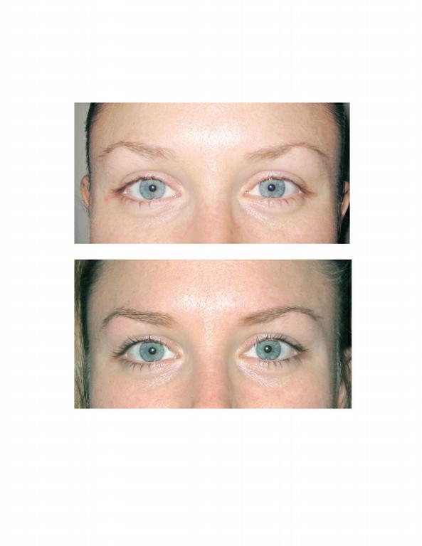 Pictures for JuvEssentials San Francisco's Premier SofTap Permanent