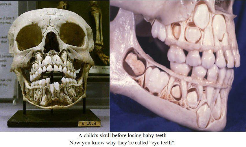Child's Skull *Trigger? Picture* BabyGaga