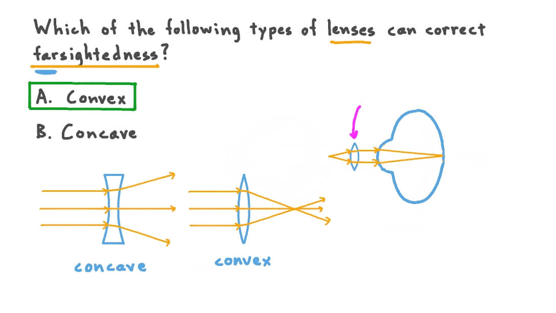 Question Video Determining the Type of Lenses Used to Correct Farsightedness Nagwa