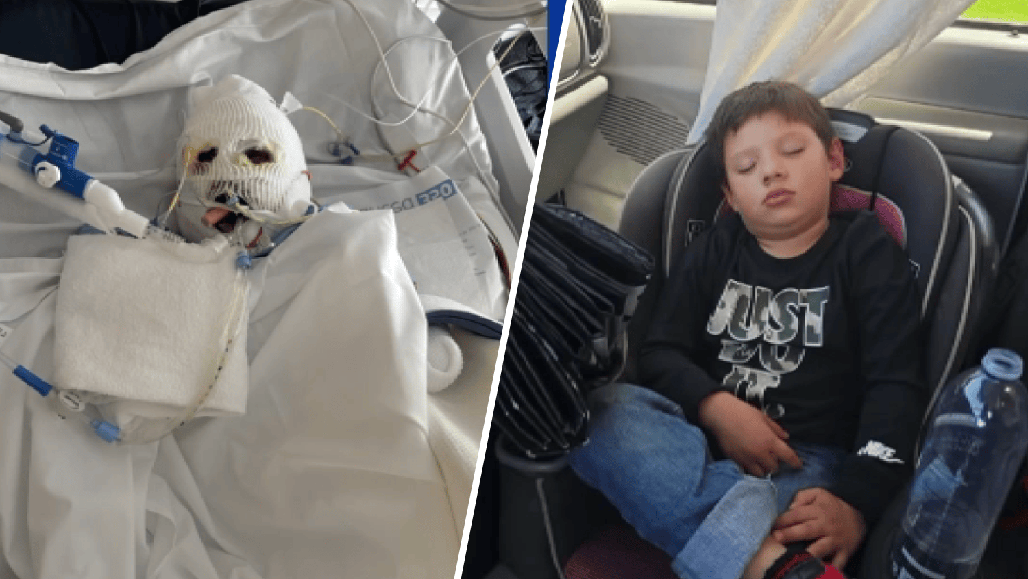 Boy Survives Fiery Crash