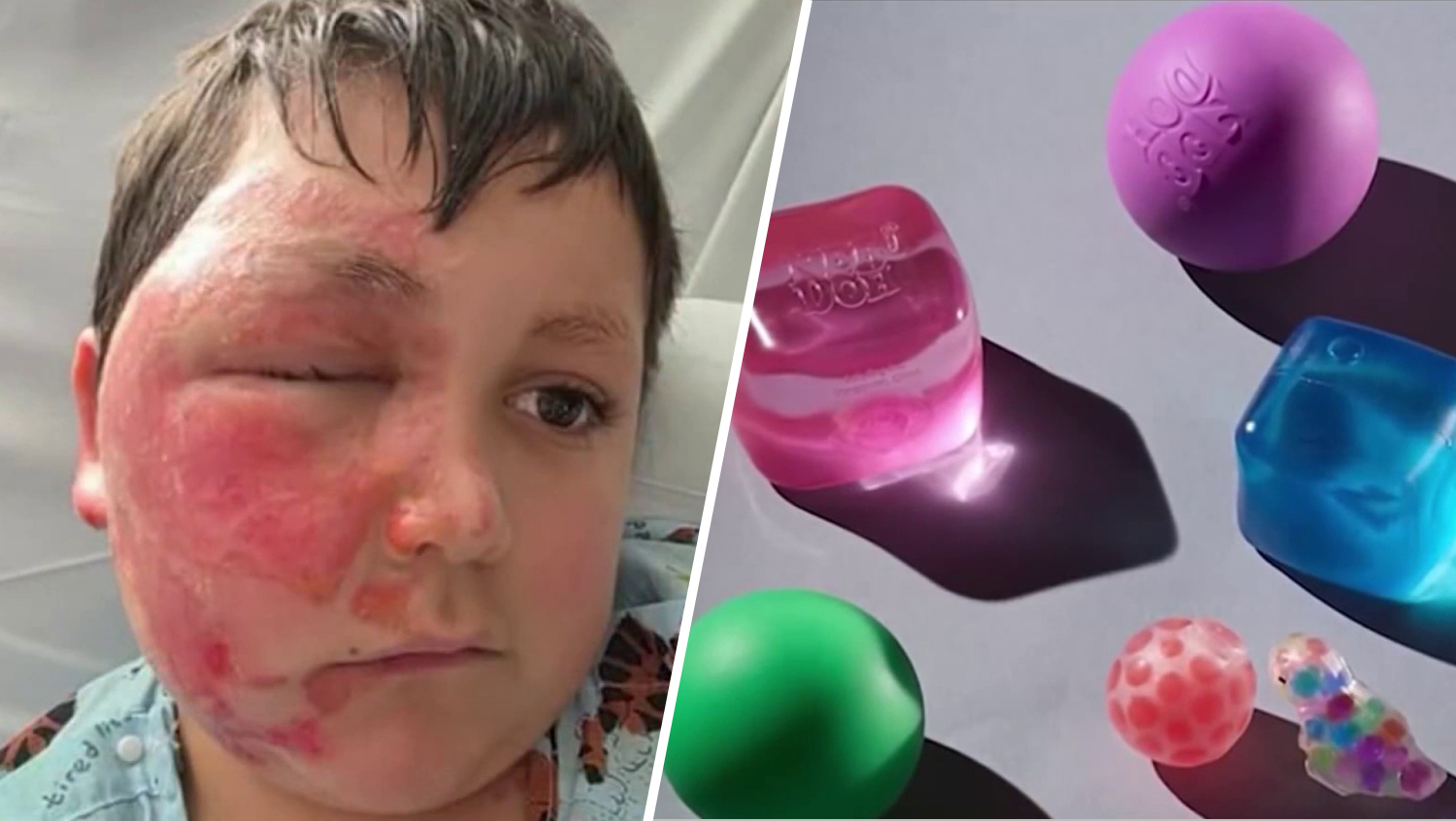 Squishy toy microwave development prompts warning after youngsters are burned – NBC New York