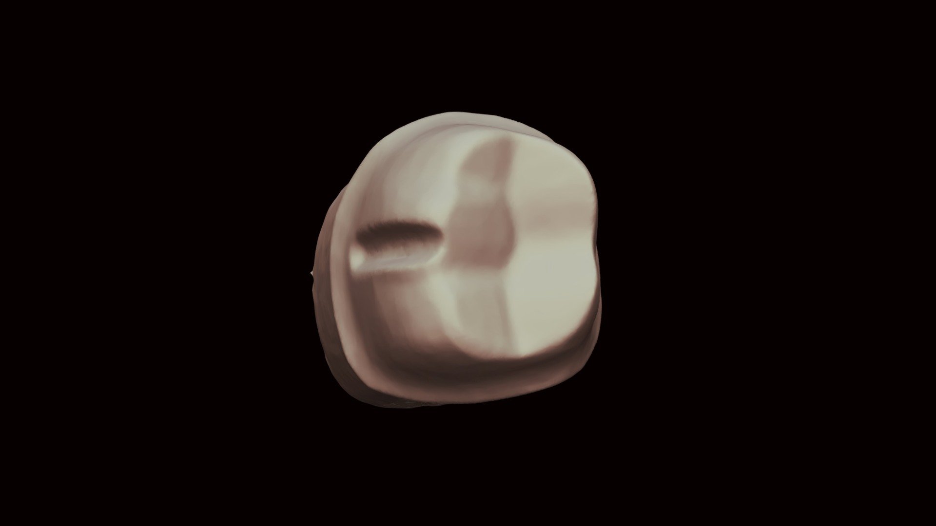 30 Yellow Tooth Prep 3D model by pkulkarni [334aab9] Sketchfab