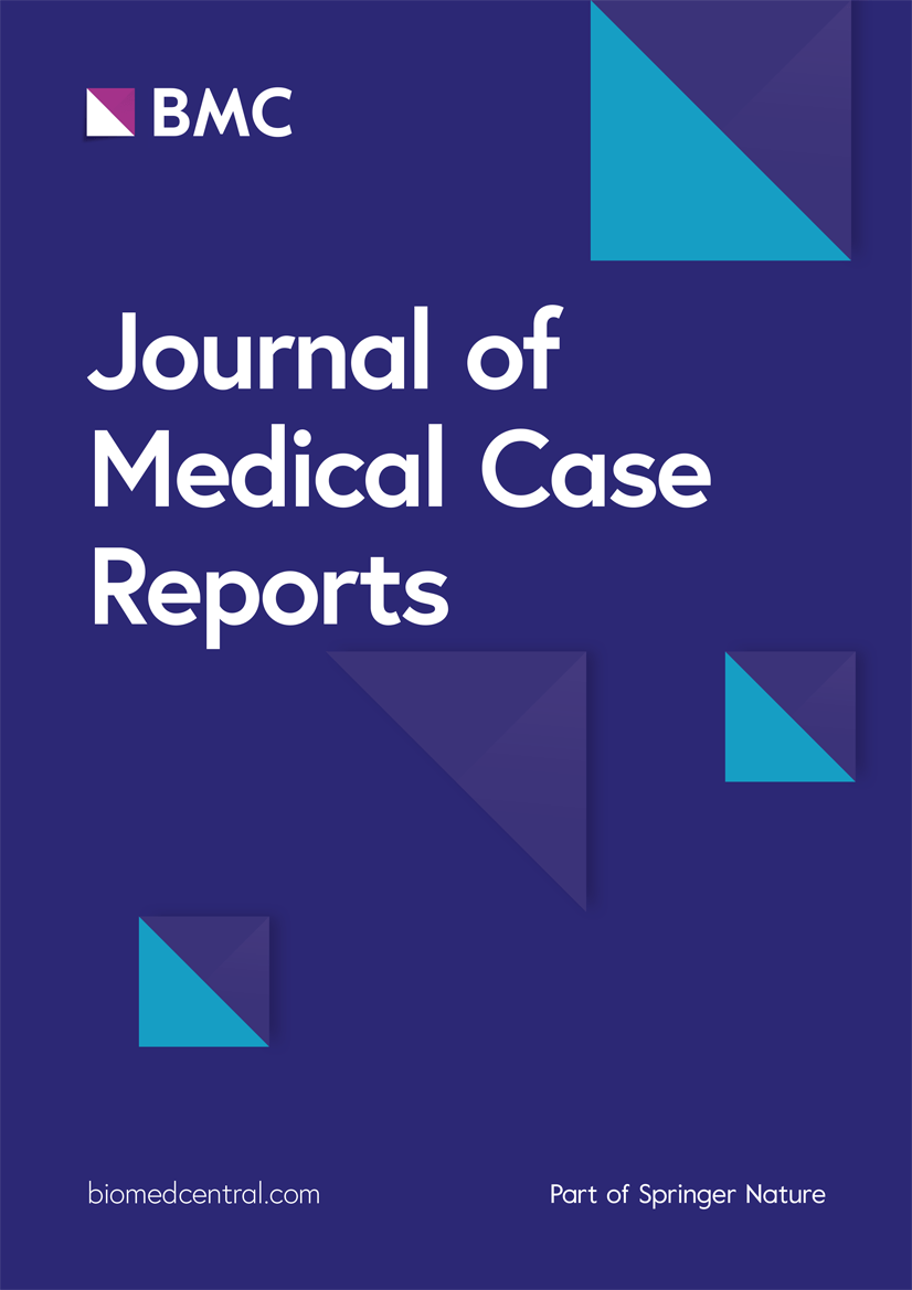 Eucalyptus oil poisoning two case reports Journal of Medical Case