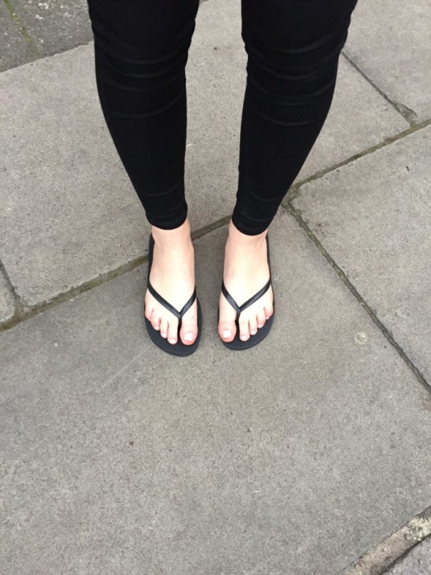 'Dangerous' flipflops are worse for your feet than heels