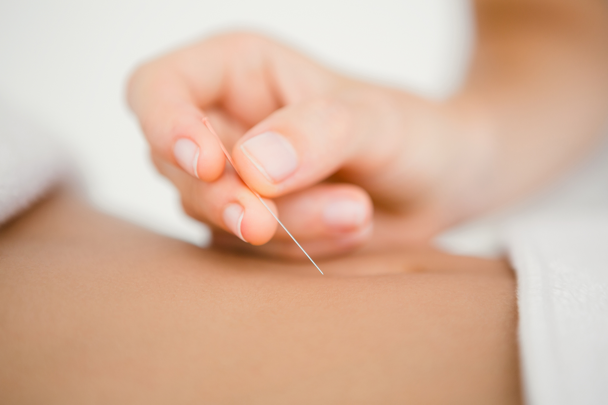 Find an acupuncturist in NYC at an alternative medicine studio